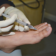 Ingrown toenail treatment at Victoria Park Podiatry